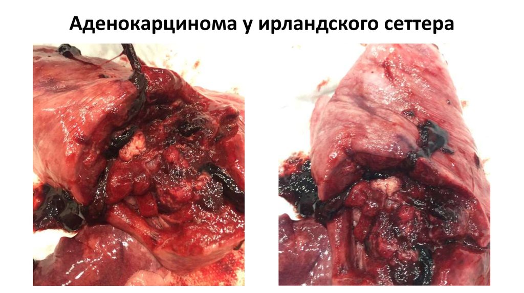 Аденокарцинома у ирландского сеттера