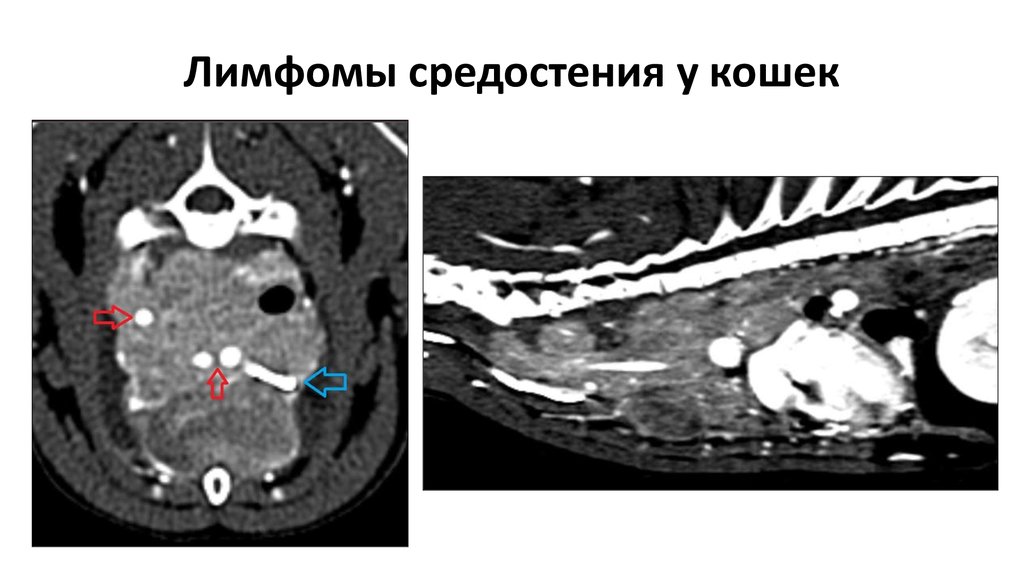 Тимома кт картина