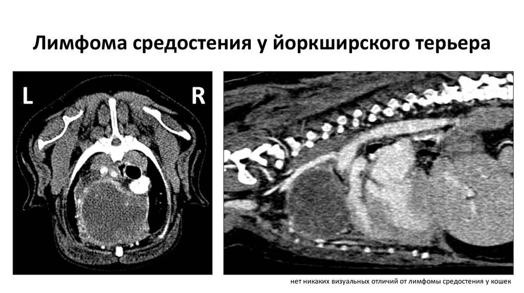 Лимфома у кошек. Лимфосаркома средостения на кт. Лимфома средостения на кт. Лимфома средостения кт картина. Опухоли переднего средостения на кт.