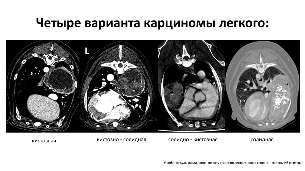 Солидное образование в легком