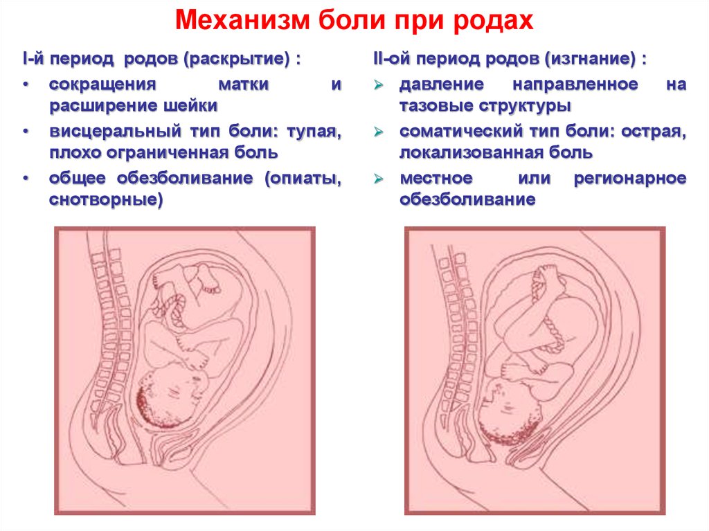 Боль при родах. Боль при родах механизм. Боль при родах с чем сравнить. Механизм возникновения родовой боли. Родовая боль сравнима.