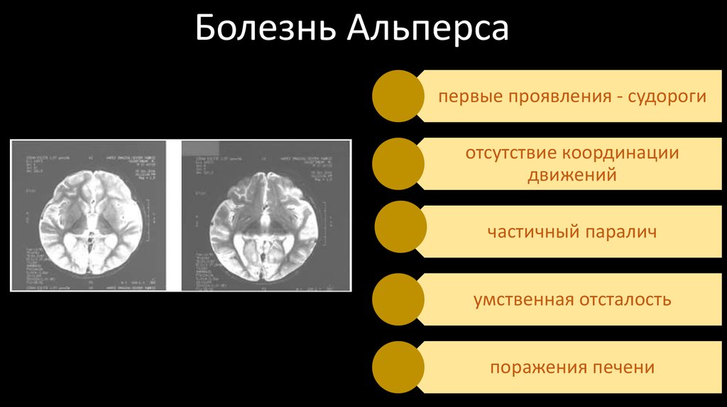 Прионные инфекции - презентация онлайн