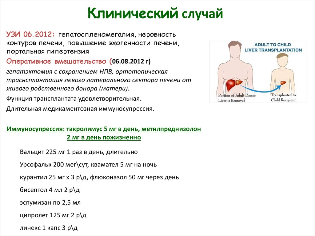 Трансплантация печени отзывы