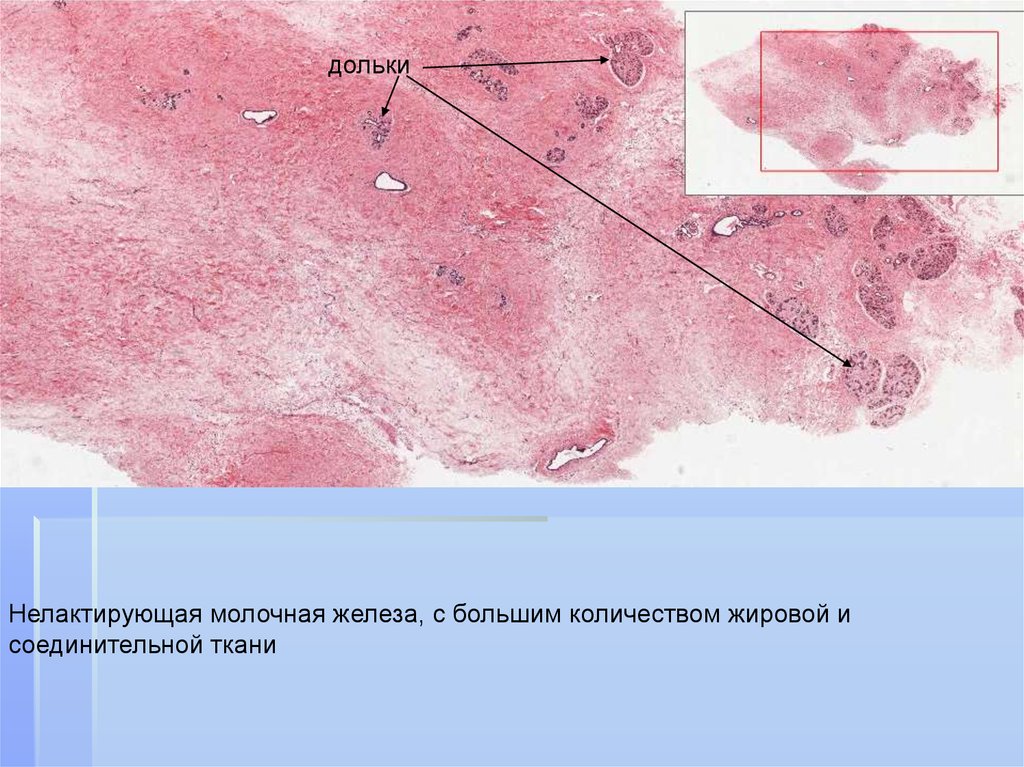 Дольки молочной железы фото. Нелактирующая молочная железа препарат. Строение нелактирующей молочной железы. Молочная железа соединительная ткань. Лактирующая и нелактирующая молочная железа гистология.