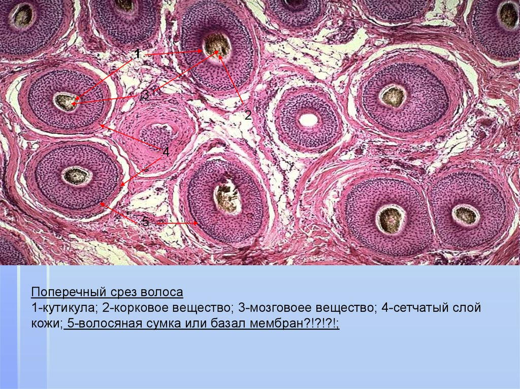 Фото препаратов поперечных срезов. Поперечный срез волоса гистология препарат. Корень волоса поперечный срез гистология. Поперечный срез волосяного фолликула гистология. Кожа волосистой части головы гистология поперечный срез.