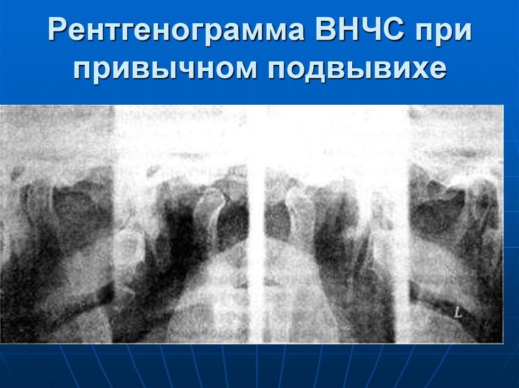 Лучевая диагностика внчс презентация