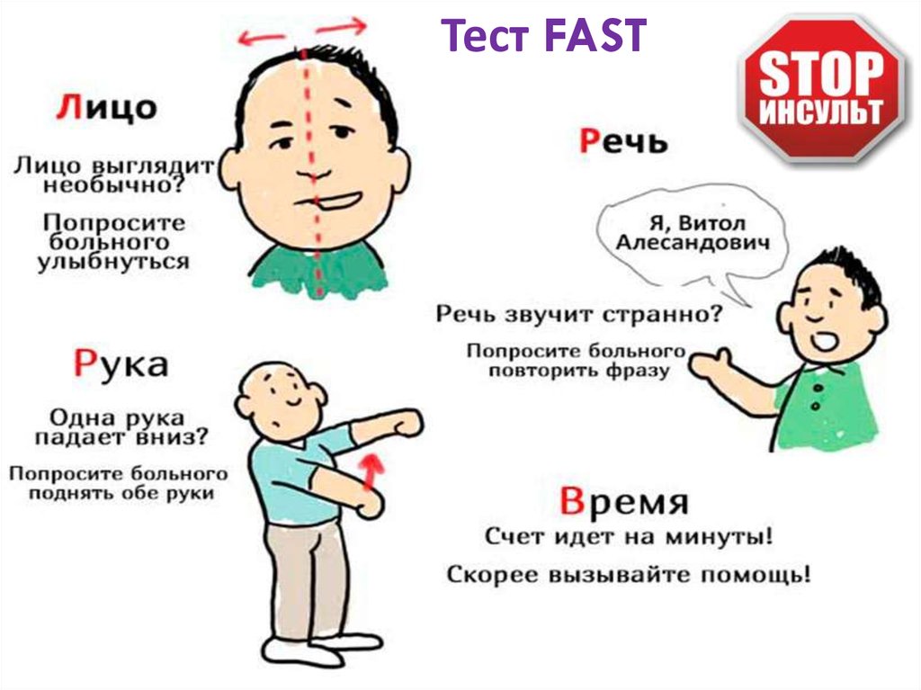 Face stroke. Симптомы инсульта фаст. Fast инсульт. Тест на инсульт. Инсульт фаст тест.