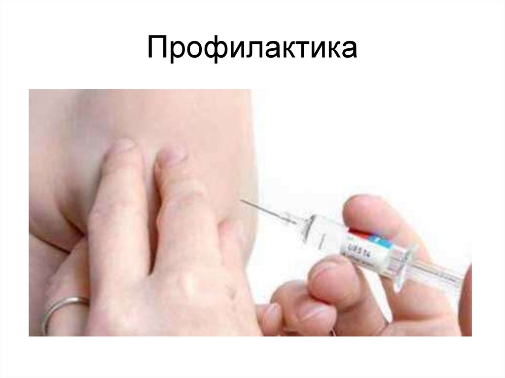 Профилактика