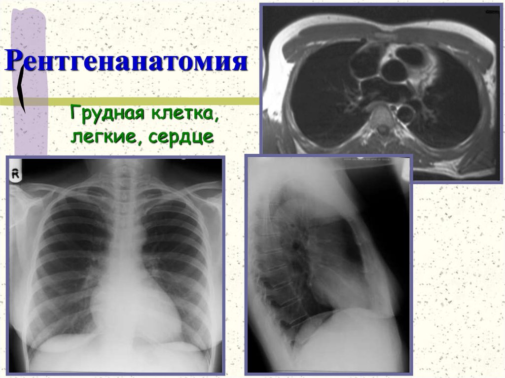 Рентгенанатомия
