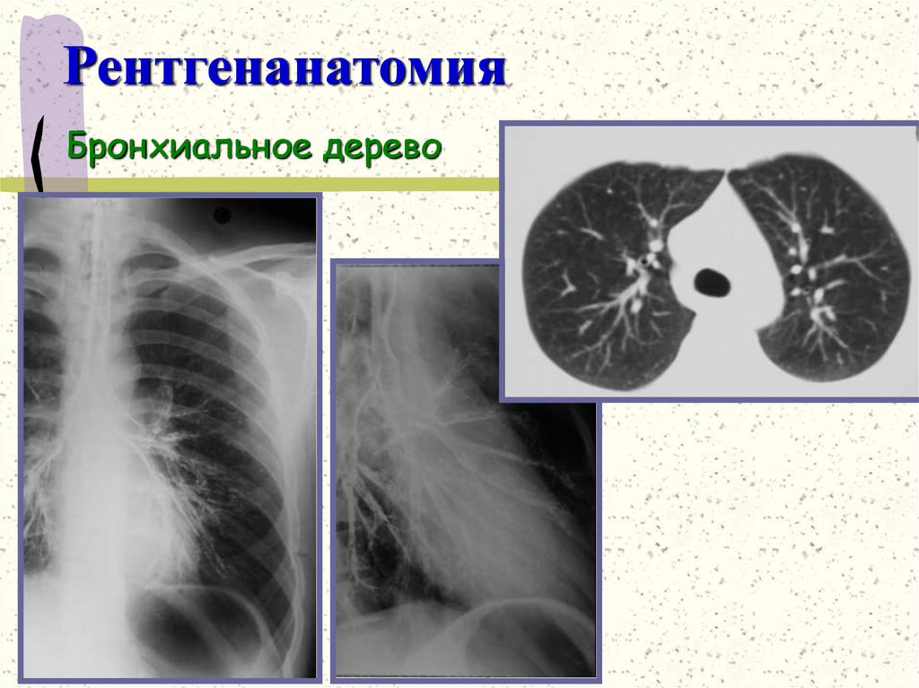 Рентгенанатомия