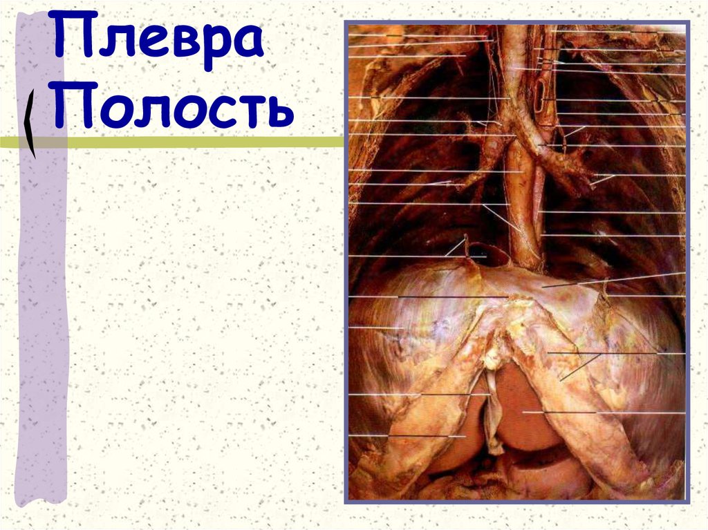 Плевра Полость