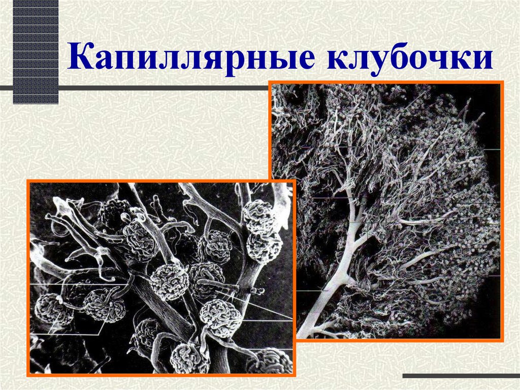 Капиллярные клубочки