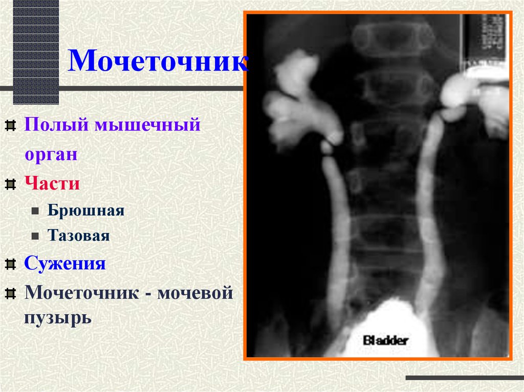 Мочеточник