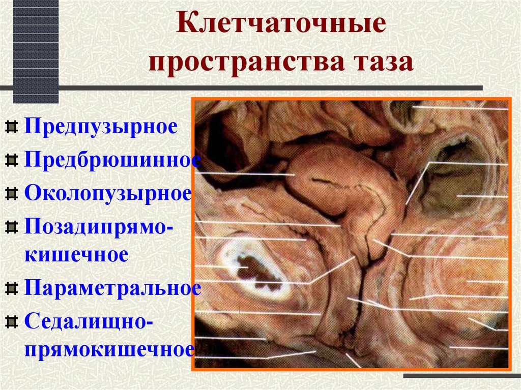 Клетчаточные пространства таза