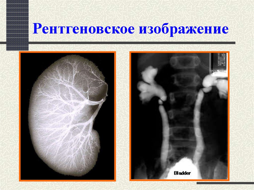 Для детского рентгеновского рисунка характерно