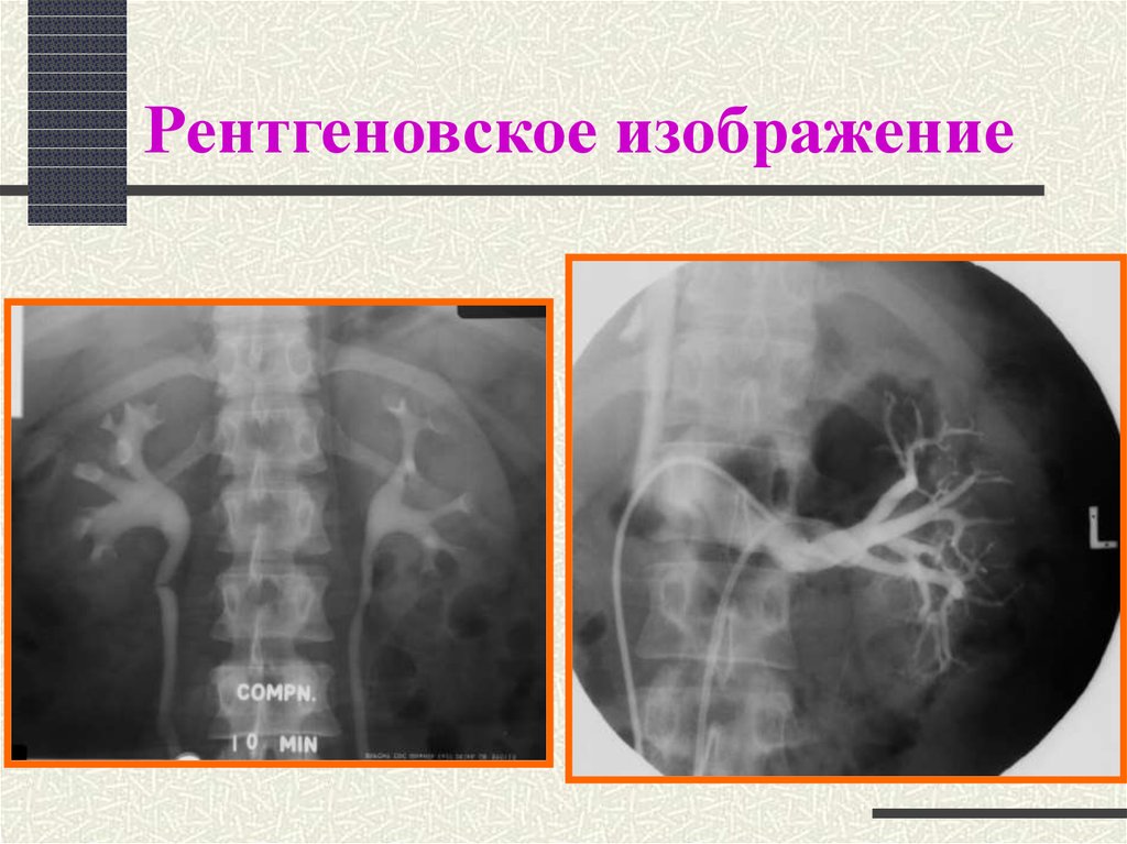 Рентгеновское изображение