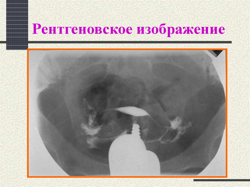 Рентгеновское изображение