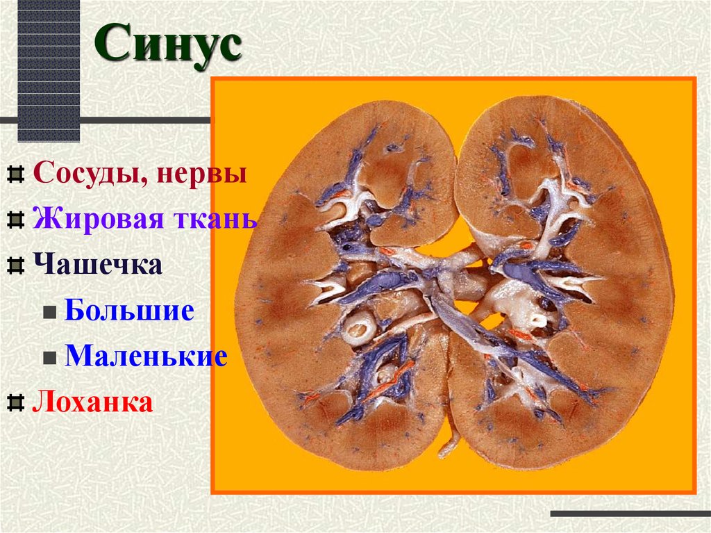 Синус почки фото