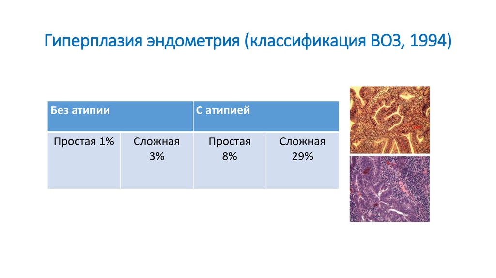 Гиперплазия постменопаузе отзывы. Классификация воз гиперплазии эндометрия 1994. Классификация гиперпластических процессов эндометрия воз. Классификация гиперпластических процессов эндометрия воз 1994. Гиперпластические процессы эндометрия воз 1994.