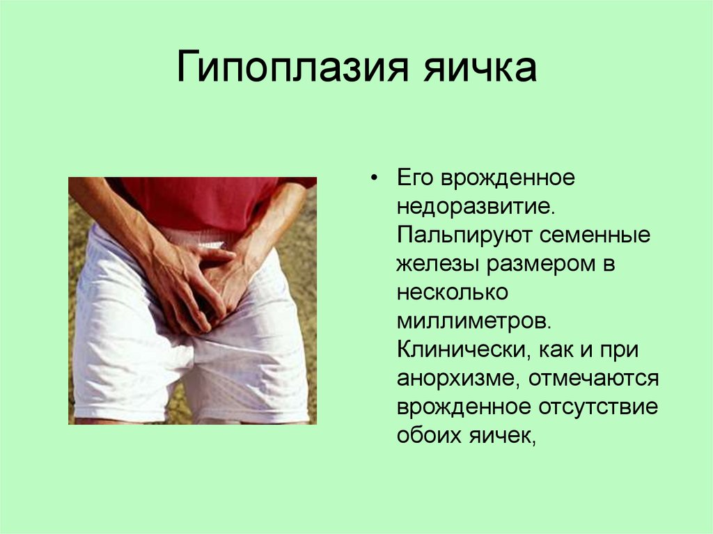 Гипоплазия яичка