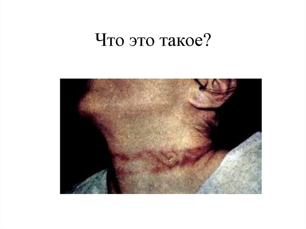 Что это такое?