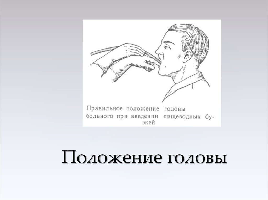 Положение затылка. Положение головы. Неправильное положение головы. Положение головы виды. Положение головы нулевая позиция это.