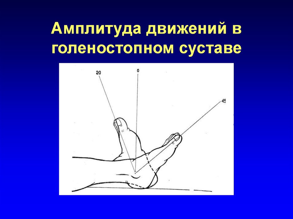 Объем движений. Амплитуда движений в голеностопном суставе. Амплитуда движений в суставах. Сгибание и разгибание в голеностопном суставе. Объем движений в голеностопном суставе.