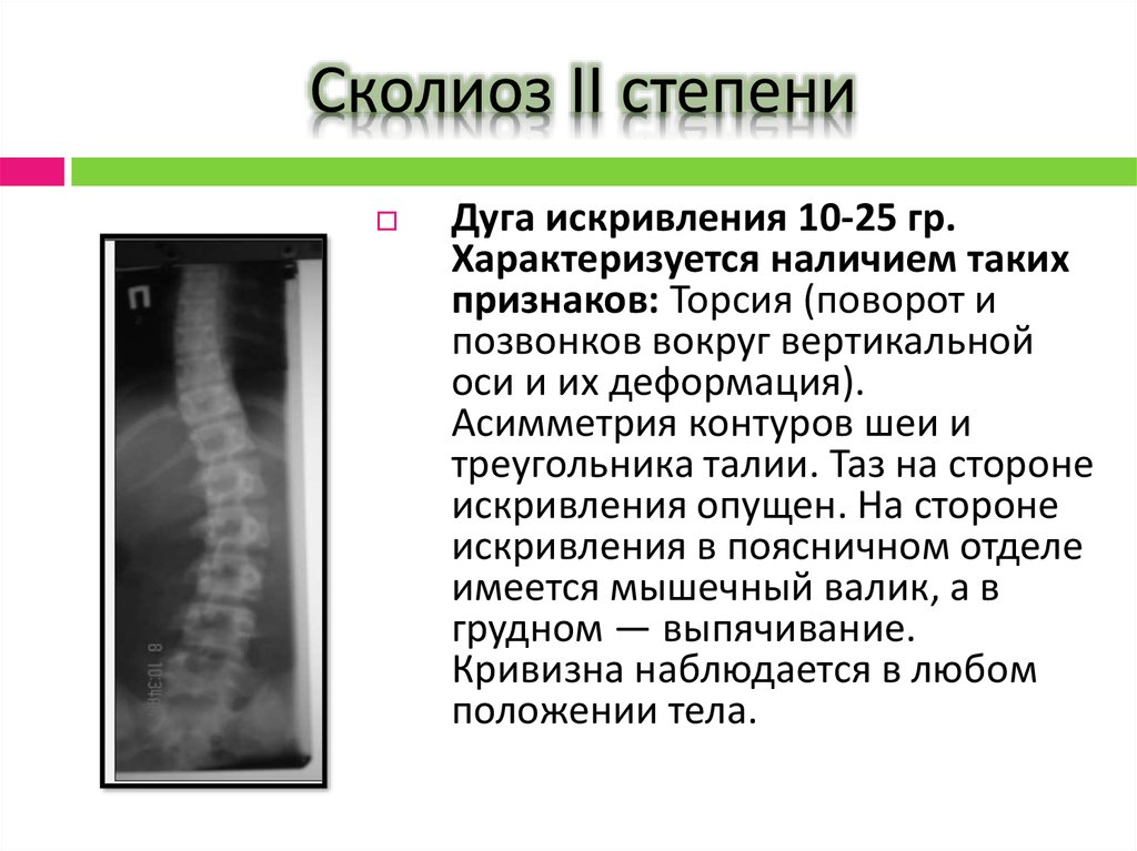 Степени искривления позвоночника. Сколиотическая деформация позвоночника рентген. Сколиоз 2 степени рентген. Сколиоз 1 степени рентген. Сколиоз 2 степени рентген заключение.