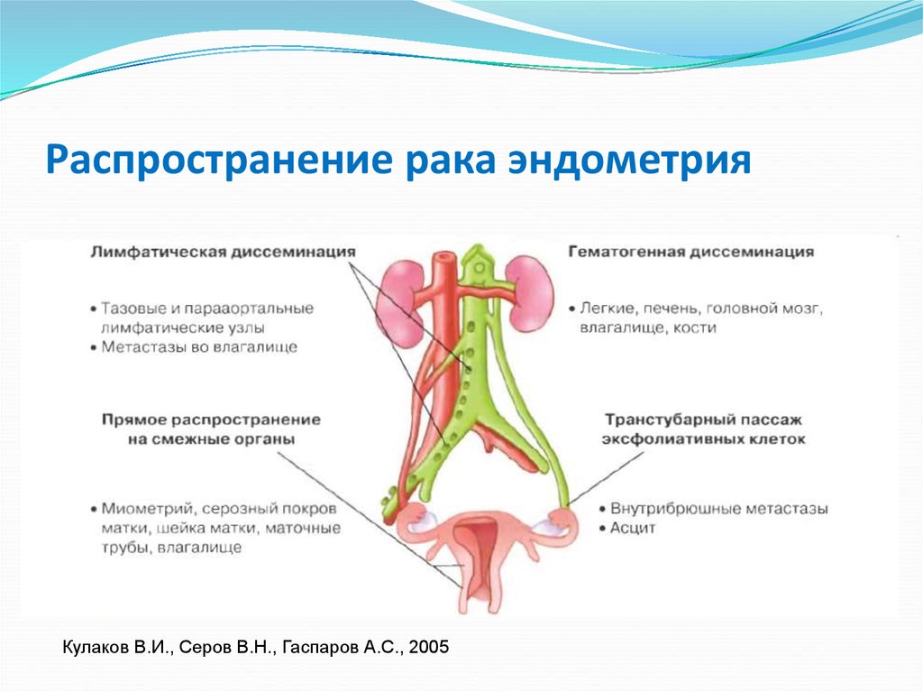 Лечение рака эндометрия