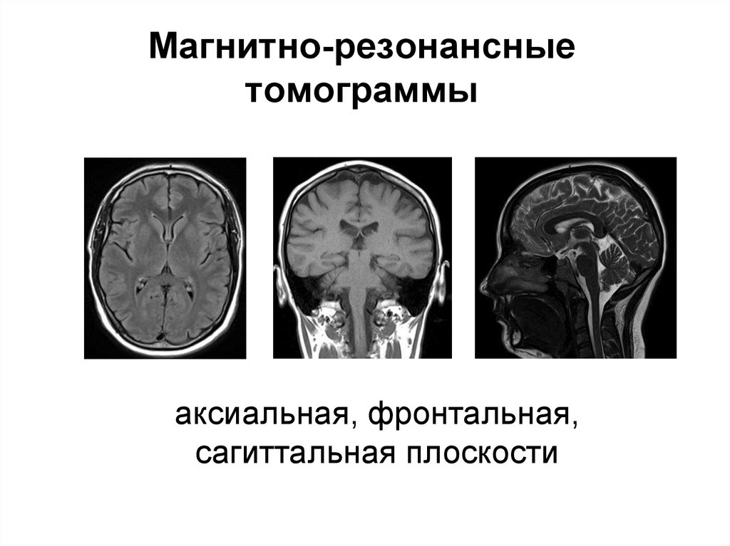 Лучевая диагностика нервной системы презентация