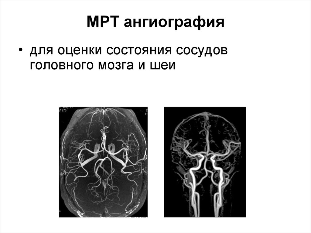 Лучевая диагностика заболеваний головы и шеи презентация