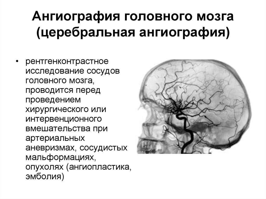 Лучевая диагностика нервной системы презентация