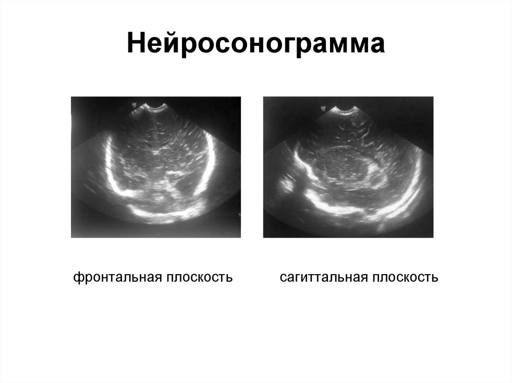 Лучевая диагностика нервной системы презентация