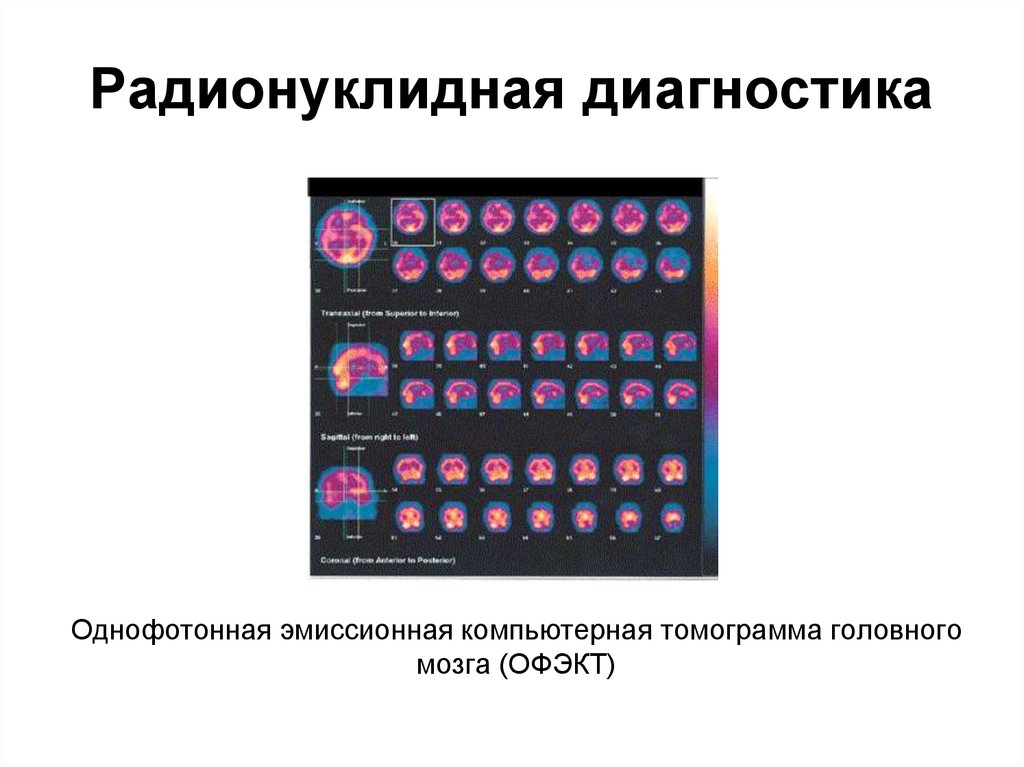 Лучевая диагностика нервной системы презентация