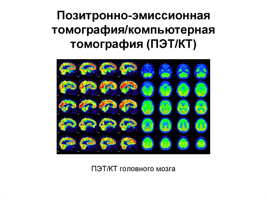 Лучевая диагностика нервной системы презентация