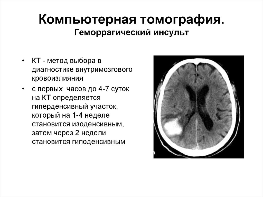 Лучевая диагностика нервной системы презентация