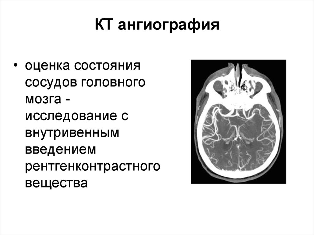 Лучевая диагностика нервной системы презентация