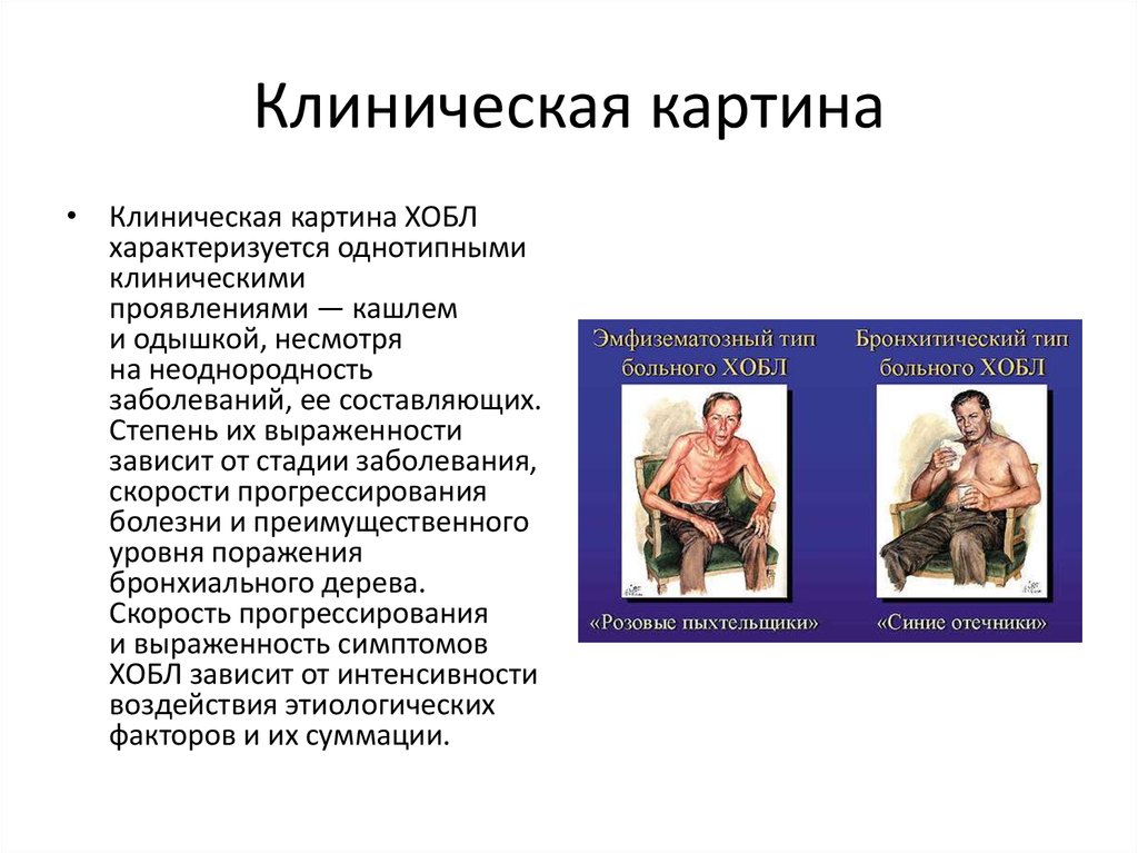 Клиническая картина