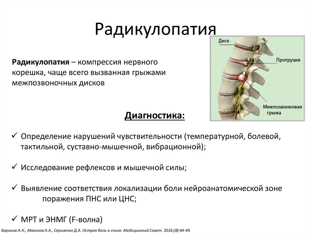 Остеохондроз причины. Корешок с1 поясничного отдела позвоночника. Симптомы радикулопатии l4. Радикулопатия l5 корешковый синдром. Радикулопатия шейного отдела позвоночника с5с7.