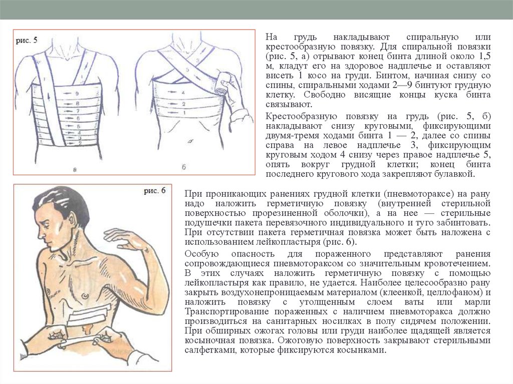 Ушиб грудной клетки карта вызова