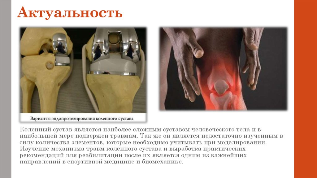 Распределение нагрузки на мышцы коленного сустава человека при ...