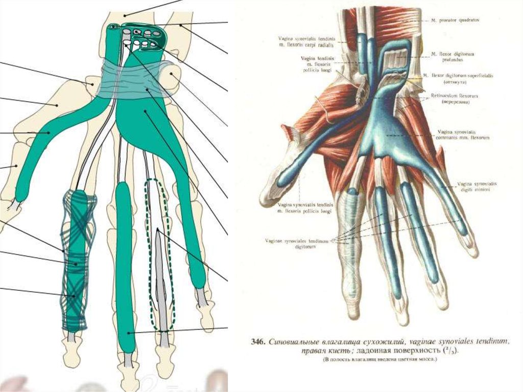 Каналы запястья топографическая анатомия схема