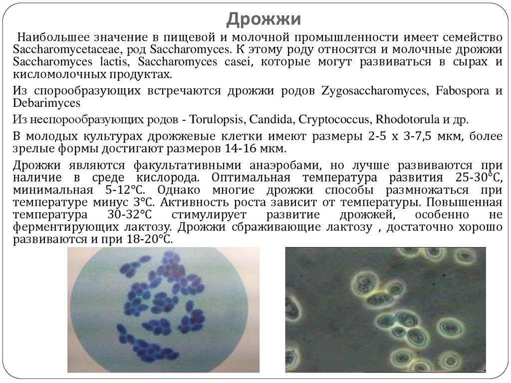 Культуральными свойствами бактерий называются. Дрожжей Saccharomyces lactis. Практическое значение дрожжей. Оптимальная температура для развития дрожжей. Значение дрожжей в пищевой промышленности.