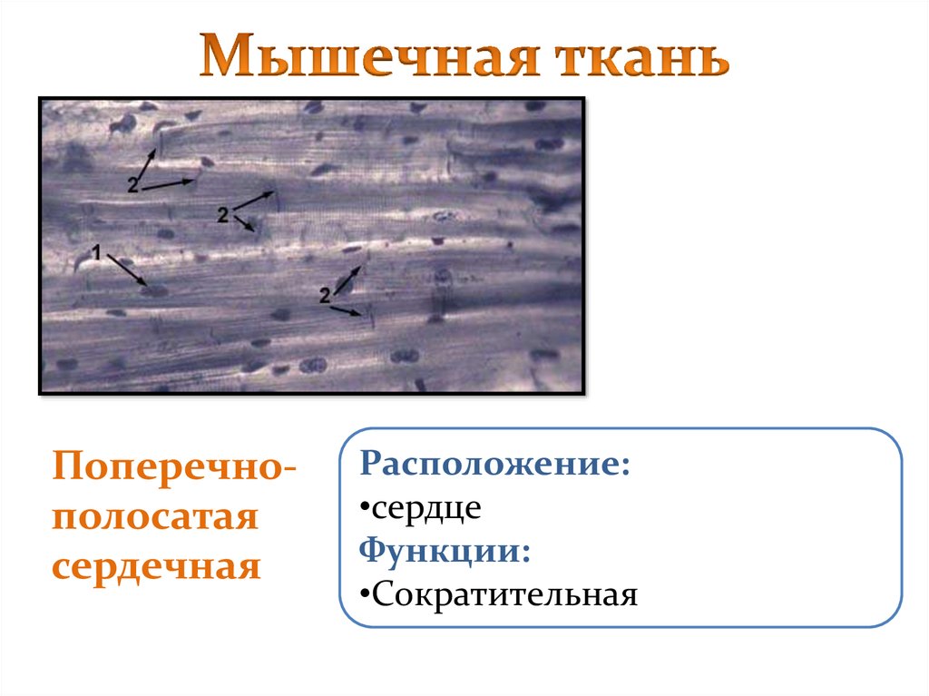 Поперечно полосатая сердечная. Поперечно полосатая сердечная функции. Поперечно полосатая сердечная расположение. Поперечно полосатая сердечная ткань функции. Функции поперечно полосатой сердечной мышечной ткани.