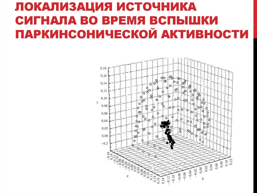Локализация источника сигнала во время вспышки паркинсонической активности