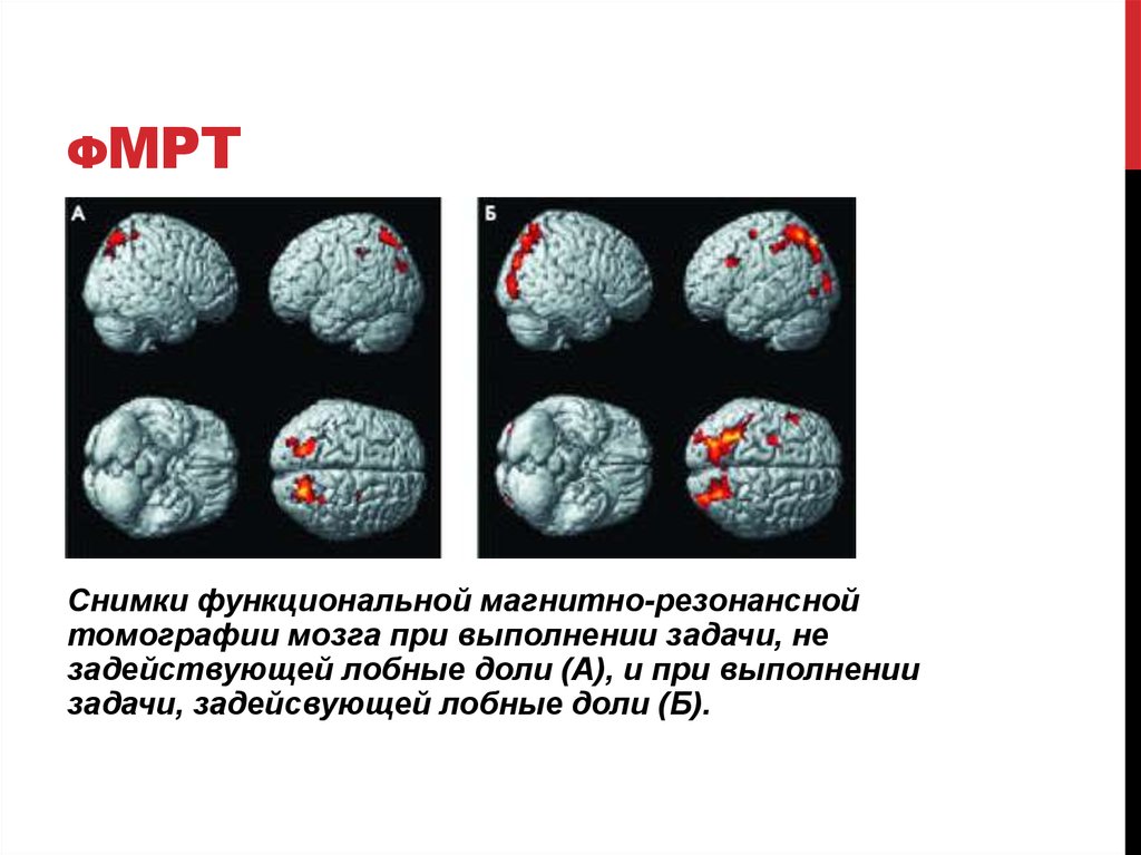фМРТ