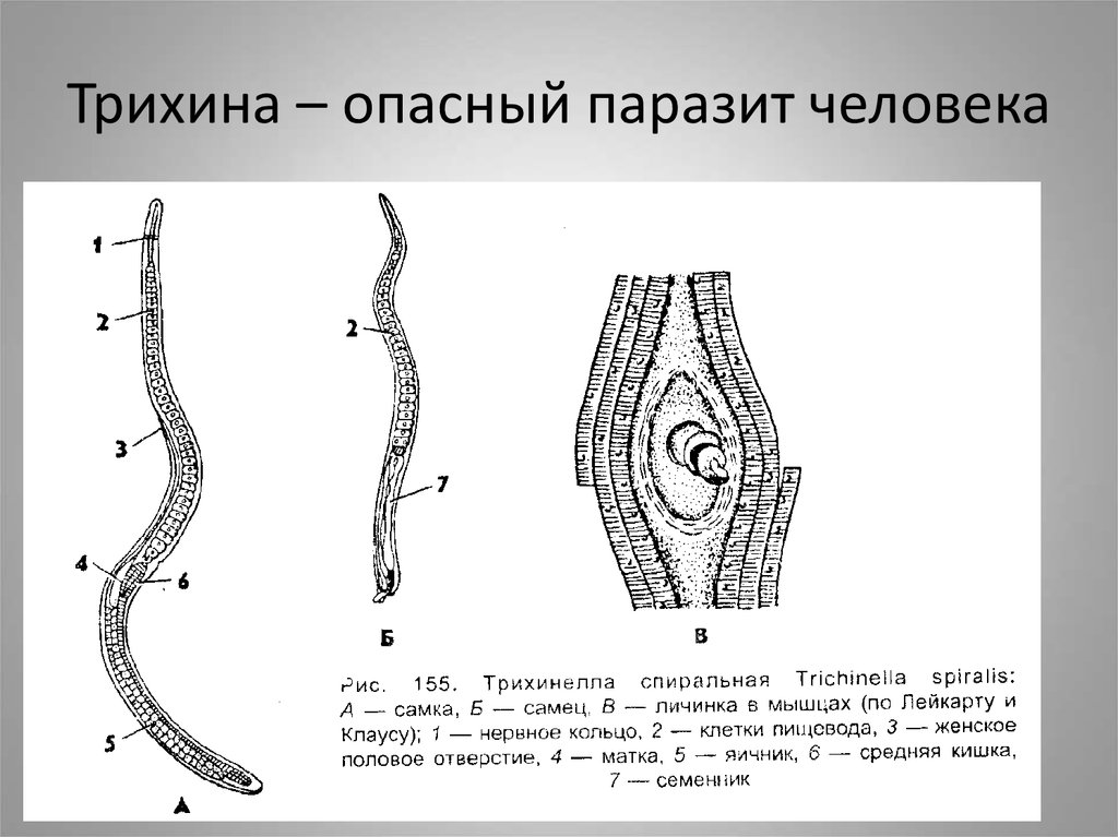 Инкапсулированные личинки трихинеллы в мышцах рисунок с обозначениями