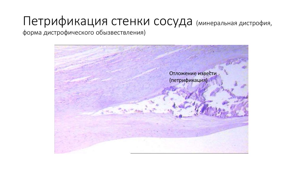 Подпишите виды дистрофий рисунки