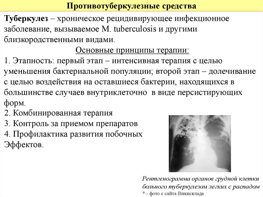 Заболевание туберкулез у человека вызывает