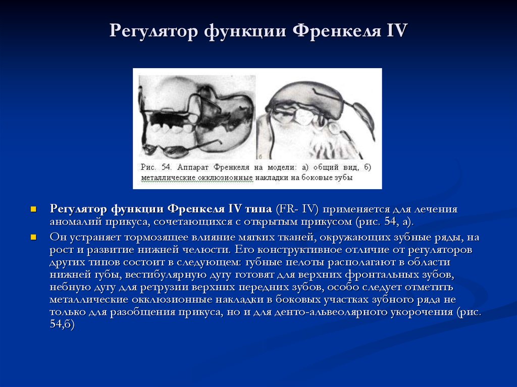 Регулятор функций 1 типа